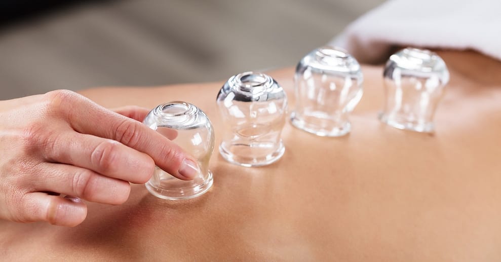 30 oder 60 Min. Schröpf-Massage für 1 Person inkl. Getränk Berlin OXGE.com Special Offers, Deals & Discounts in Germany