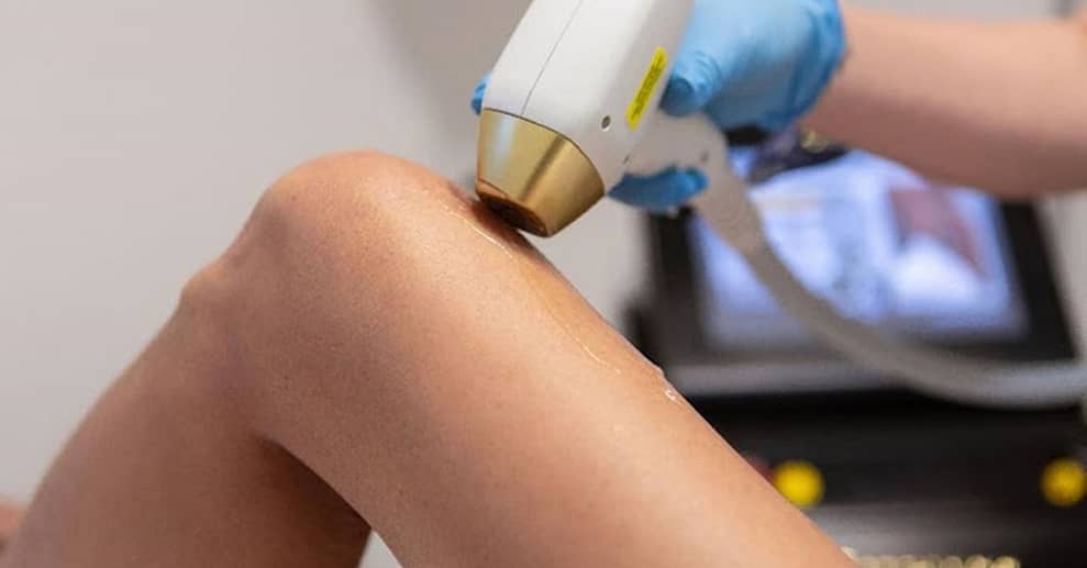3x Laser-Haarentfernung an kleiner/großer Zone / 1x Ganz-/Oberkörper München OXGE.com Special Offers, Deals & Discounts in Germany