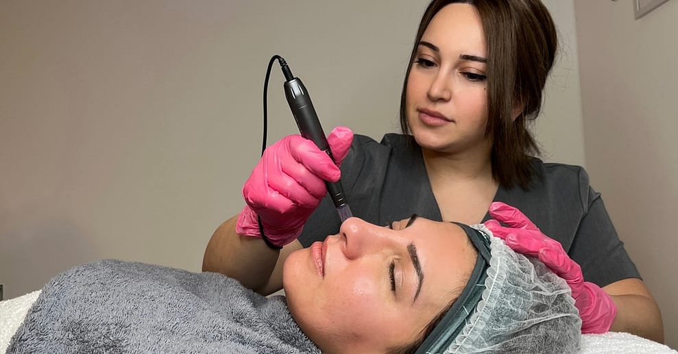 60 Min. Microneedling / BB Glow / klassische Gesichtsbehandlung Aachen OXGE.com Special Offers, Deals & Discounts in Germany