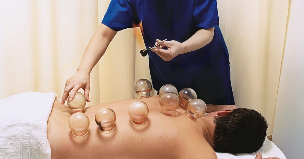 60 Min. Schröpftherapie Berlin OXGE.com Special Offers, Deals & Discounts in Germany