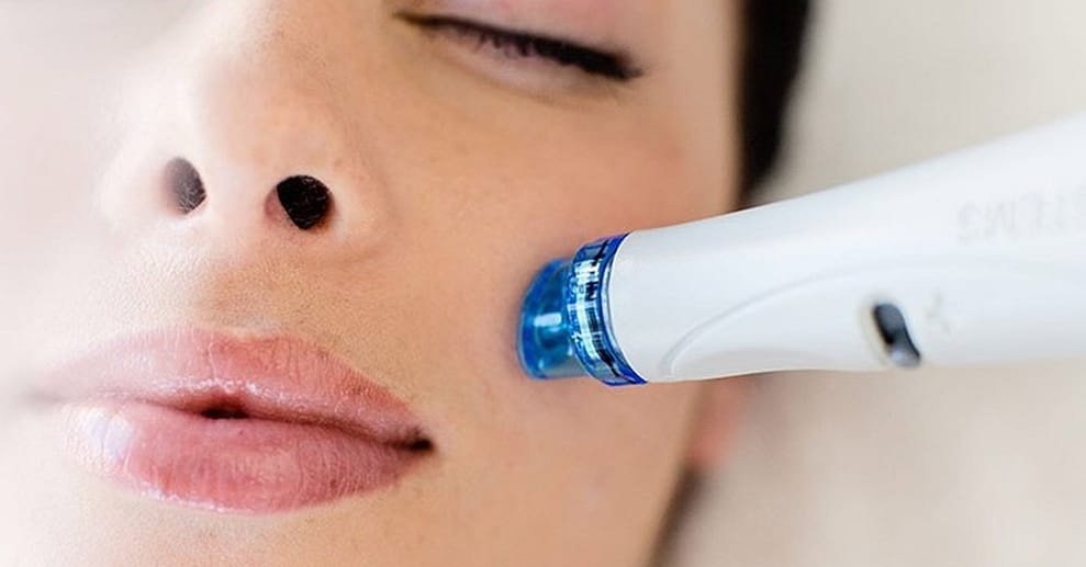 Aqua Facial-Gesichtstiefenreinigung Karlsruhe OXGE.com Special Offers, Deals & Discounts in Germany