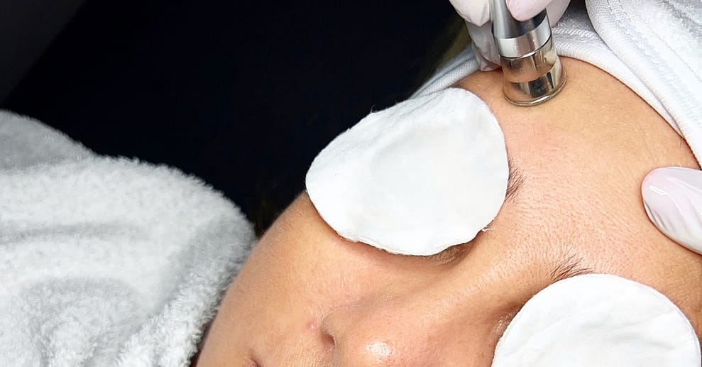 BB-Glow-Behandlung inkl. Microneedling opt. mit Wimpern-/Brauenlifting München OXGE.com Special Offers, Deals & Discounts in Germany