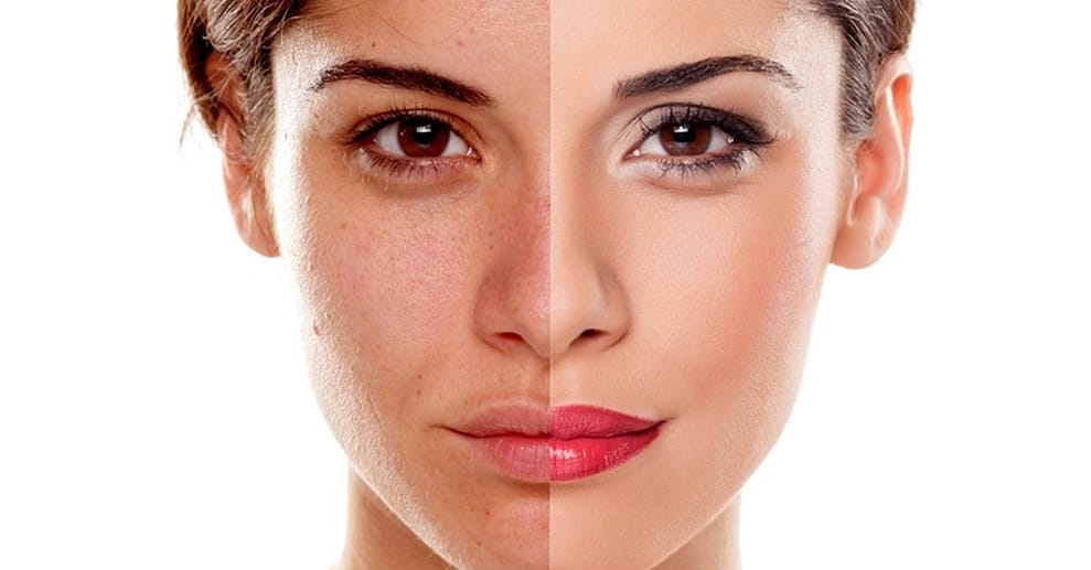 Bis zu 75% Rabatt auf den Kosmetische Gesichtsbehandlung bei Beauty Rebel Berlin OXGE.com Special Offers, Deals & Discounts in Germany