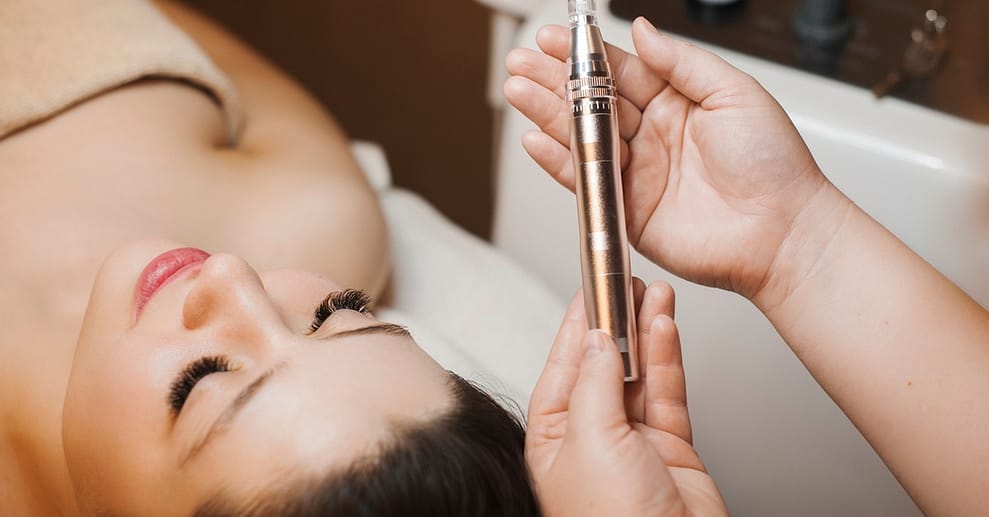 Diamant-Mikrodermabrasion Stuttgart OXGE.com Special Offers, Deals & Discounts in Germany