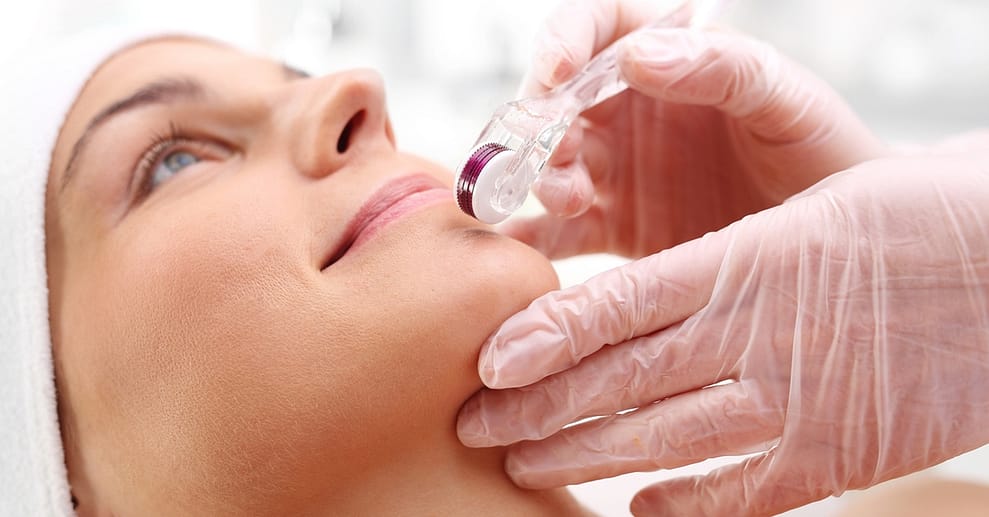 Microneedling mit Hyaluron-Serum Berlin OXGE.com Special Offers, Deals & Discounts in Germany