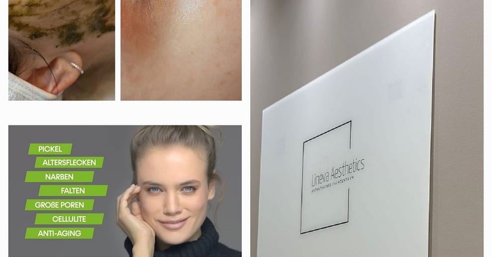 Gesichtsbehandlung – Anti-Aging Frankfurt OXGE.com Special Offers, Deals & Discounts in Germany