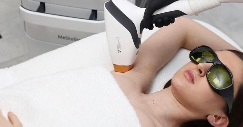 Haarentfernung mit Diodenlaser an 1 Zone nach Wahl für 1 Person Frankfurt OXGE.com Special Offers, Deals & Discounts in Germany