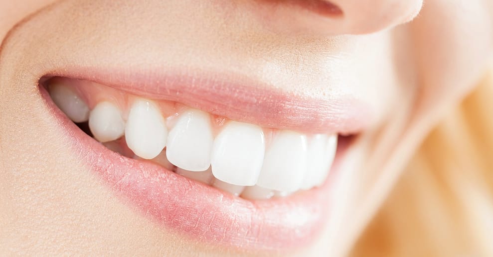 Kosmetisches Bio-Zahn-Bleaching Berlin OXGE.com Special Offers, Deals & Discounts in Germany