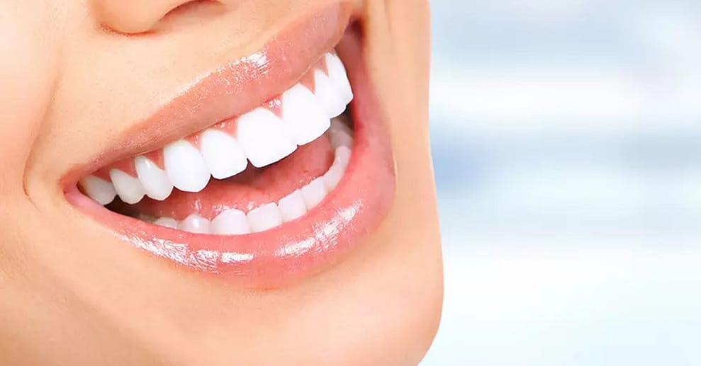 Kosmetisches Zahn-Bleaching Berlin OXGE.com Special Offers, Deals & Discounts in Germany