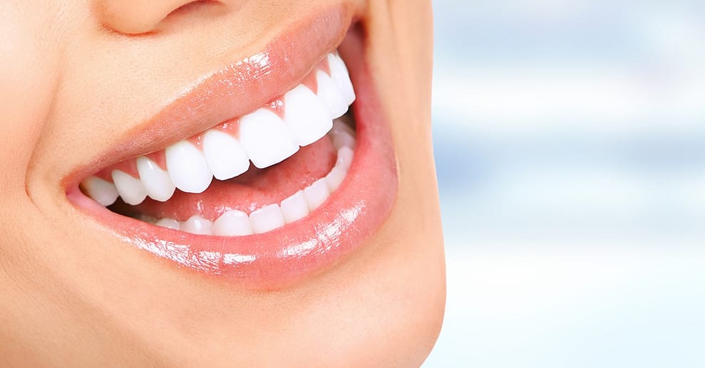 Strahlendes Lächeln: 60 Min. kosmetisches Zahn-Bleaching für 1 Person Essen OXGE.com Special Offers, Deals & Discounts in Germany
