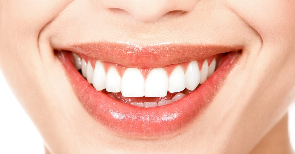 Kosmetisches Zahn-Bleaching Essen OXGE.com Special Offers, Deals & Discounts in Germany