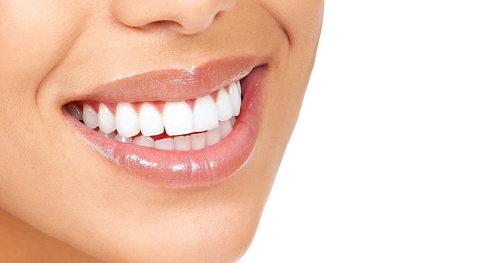 Kosmetisches Zahn-Bleaching Essen OXGE.com Special Offers, Deals & Discounts in Germany