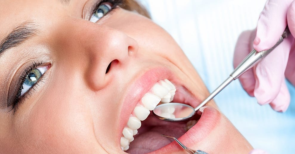 Kosmetisches Zahn-Bleaching Mannheim OXGE.com Special Offers, Deals & Discounts in Germany