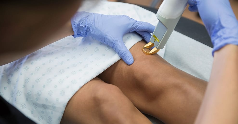 Laser-Behandlung von Besenreisern Wiesbaden OXGE.com Special Offers, Deals & Discounts in Germany