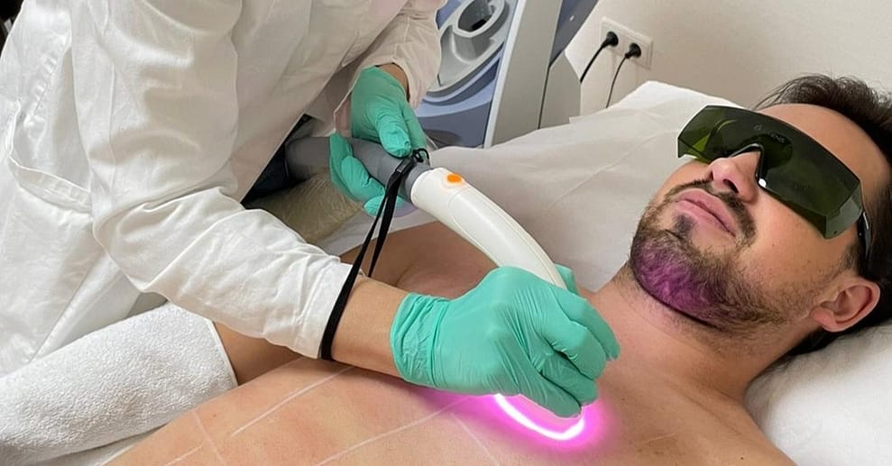 Laser-Haarentfernung Berlin OXGE.com Special Offers, Deals & Discounts in Germany
