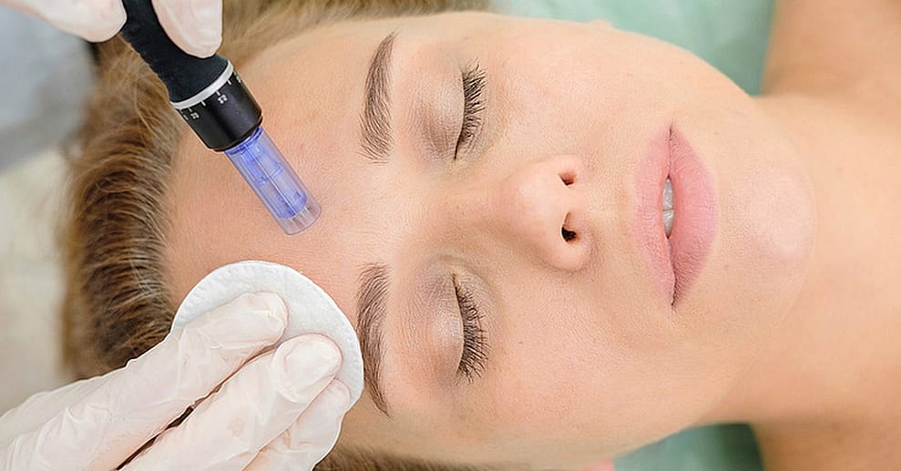 Micro-Needling Dresden OXGE.com Special Offers, Deals & Discounts in Germany