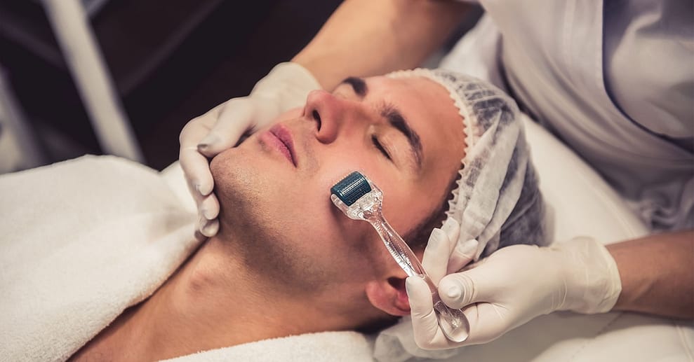 1-3 Behandlungen: 60 Min. Microneedling für 1 Person Hannover OXGE.com Special Offers, Deals & Discounts in Germany