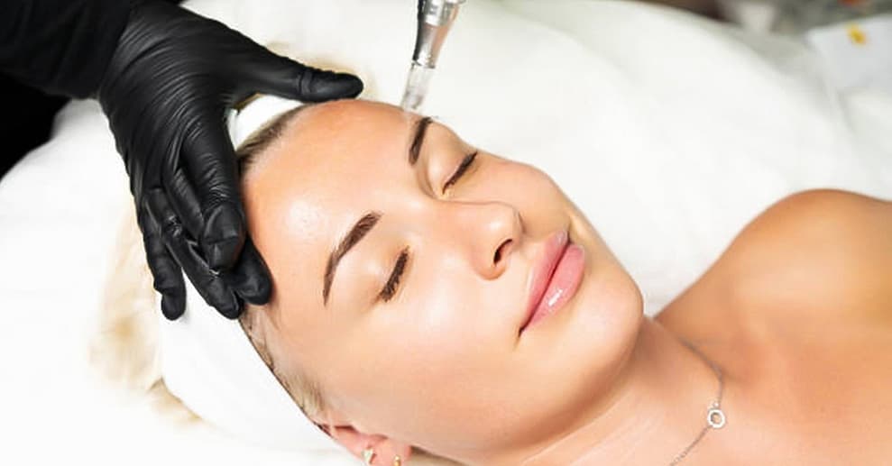 Microneedling inkl. Ampulle Hannover OXGE.com Special Offers, Deals & Discounts in Germany