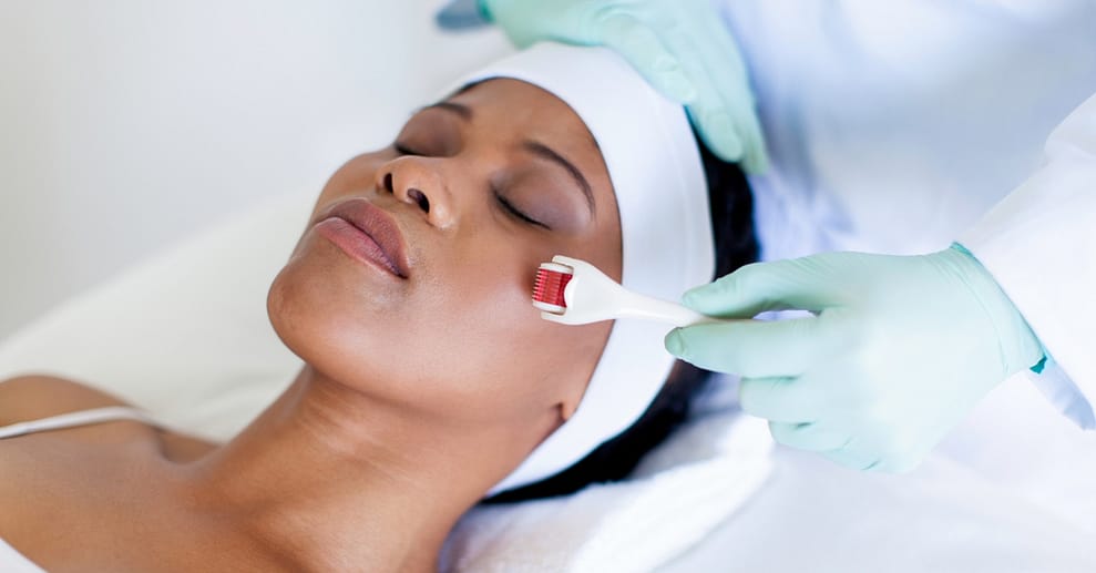 Schöne, frische Haut mit einer 45 Min. Microneedling-Behandlung Frankfurt OXGE.com Special Offers, Deals & Discounts in Germany