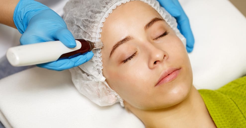 Strahlende Haut: 60 Min. Microneedling-Gesichtsbehandlung für 1 Person Hamburg OXGE.com Special Offers, Deals & Discounts in Germany